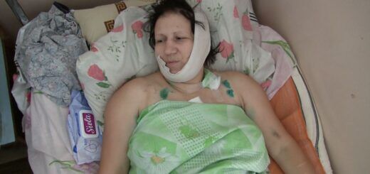 Валентина Бучок в больнице после нападения